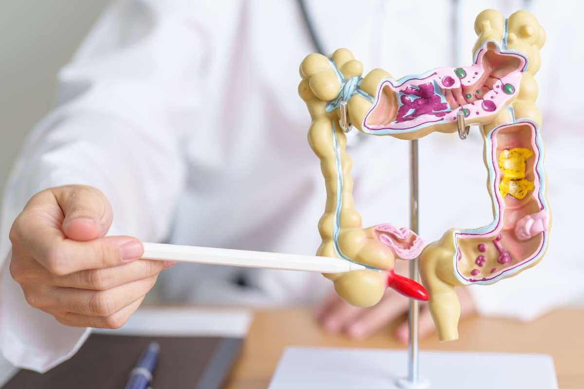 Il tumore che ringiovanisce costringe la sanità a cambiare: parte lo screening pilota under 50